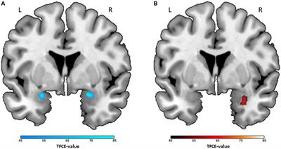 How movies move us – movie preferences are linked to differences in neuronal emotion processing of fear and anger: an fMRI study